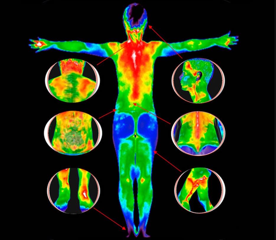 Exame termografia Clinica Vidaa